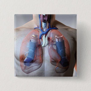 Badge Carré 5 Cm Asthme