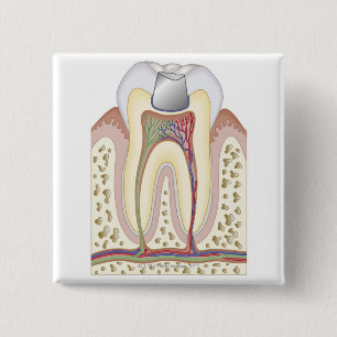 Badge Carré 5 Cm Illustration du remplissage dentaire