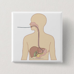 Badge Carré 5 Cm Itinéraire d'endoscope