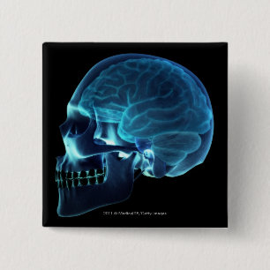 Badge Carré 5 Cm Rayon X du cerveau à l'intérieur d'un crâne
