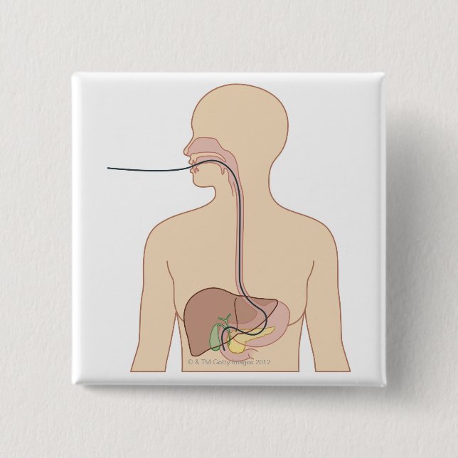 Badge Carré 5 Cm Route de l'Endoscope (Devant)