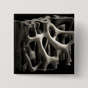 Badge Carré 5 Cm Structure d'un os avec l'ostéoporose
