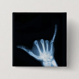 Badge Carré 5 Cm SYMBOLE Shaka X-Ray (Perdre la main)