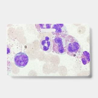 Badge GR globules blancs sur lame au microscope laborato