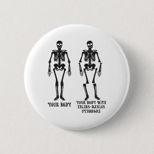 Badge Rond 5 Cm Ehlers - Votre Corps Avec Ehlers Syndrome Danlos A