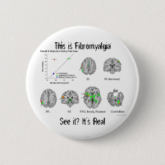 Badge Rond 5 Cm La fibromyalgie est vraie. preuve de fMRI