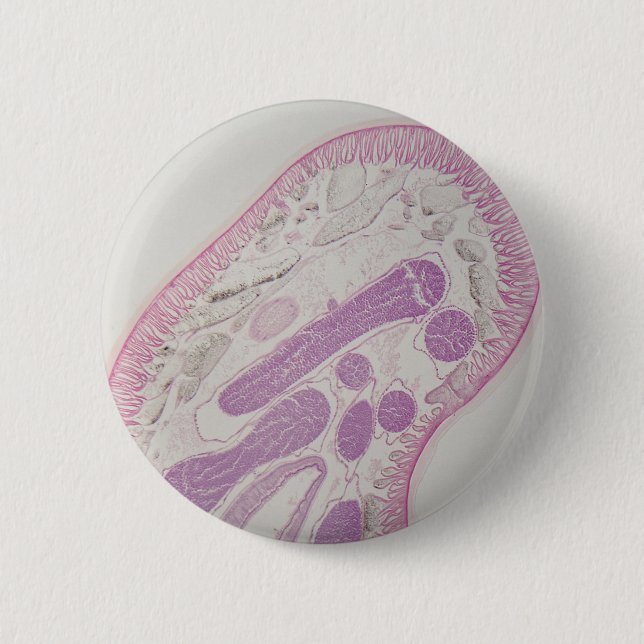 Badge Rond 5 Cm Ver parasite de nématode (espèces d'ascaride) (Devant)