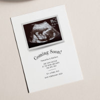 Bientôt Ultrasound Photo Carte de révélation de ge