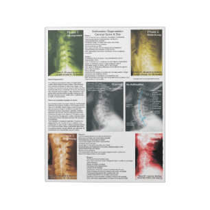 Bloc-note Éteindre la subbluxation de Pad Dégénération cervi