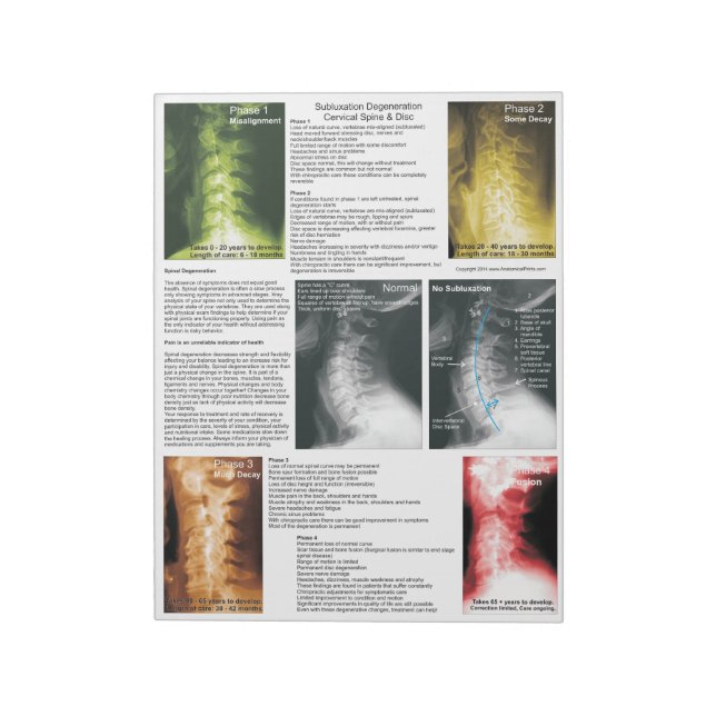 Bloc-note Éteindre la subbluxation de Pad Dégénération cervi (Tourné)