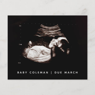 Budget Grossesse Bébé Sonogramme Ultrasons Photo