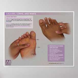 Callus, cornes et tourbières mélalogiques Poster M