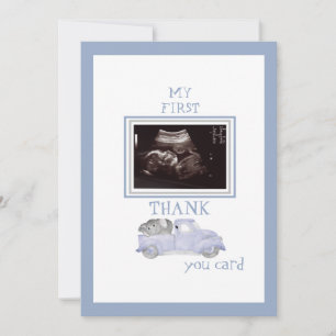 Camion photo Ultrasound Merci Blue Baby Viewpoint