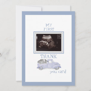 Camion photo Ultrasound Merci Blue Baby Viewpoint