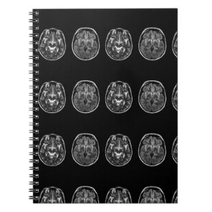 Carnet Analyse Mri du cerveau
