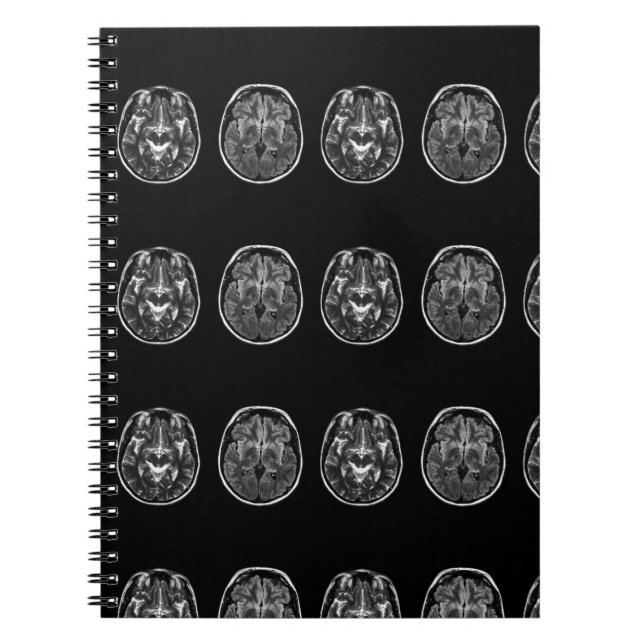 Carnet Analyse Mri du cerveau (Devant)