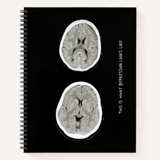 Carnet CT Scan_CTFOD_ Voici à quoi ressemble la dépressio