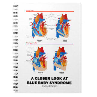 Carnet Un Regard Plus Près Sur Le Syndrome Bleu Du Bébé A