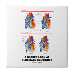 Carreau Un oeil plus attentif à l'anatomie de coeur de
