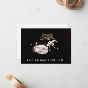 Carte De Correspondance Révélation de grossesse Bébé Ultrasons Sonogramme 