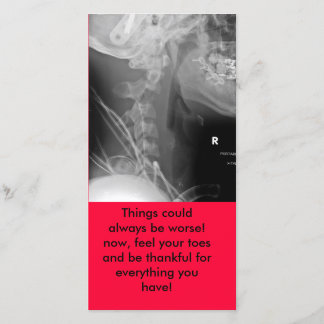 Carte De Remerciements le rayon X, choses a pu toujours être plus mauvais