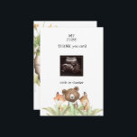 Carte De Remerciements Ultrasound Baby Boy Funny Woodland<br><div class="desc">Carte de remerciements Baby shower photo Ultrasound. La perspective du bébé. Merci du bébé. Des animaux qui dorment dans le bois. Mon garçon. Vite.</div>