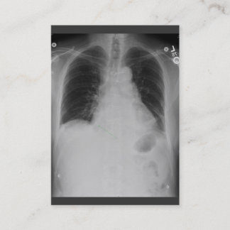 Carte De Visite ~ de rayon du coffre X potelé