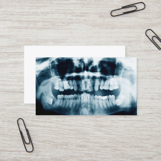 Carte De Visite Rayon X des dents (Devant/Arrière en situation)