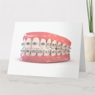 Carte Faux Teeth Set Avec Bracelets