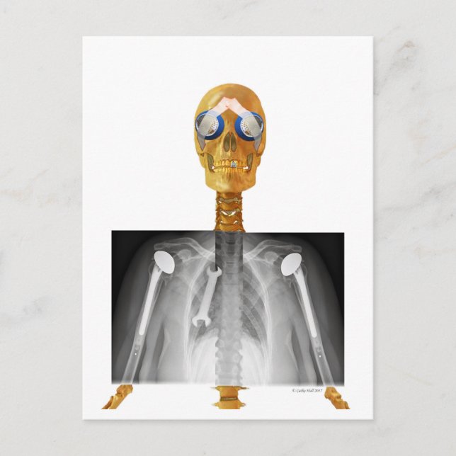 Carte postale adressée à Trump pour Trumpcare (Devant)