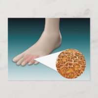 Anatomie Des Fungus Pieds Avec Agrandissement Micr