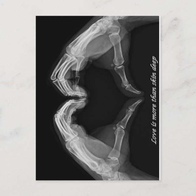 Carte Postale Art à rayons X (Devant)