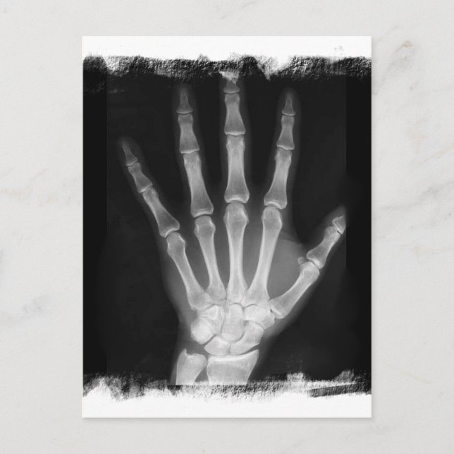 Carte Postale B&W X-ray Skeleton Main (Devant)