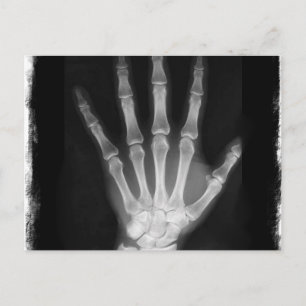 Carte Postale B&W X-ray Skeleton Main