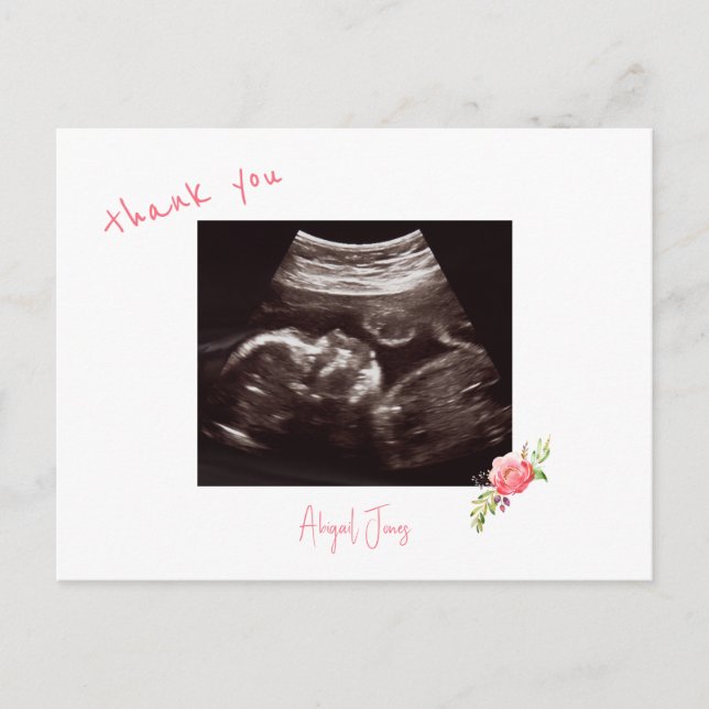 Carte Postale Baby shower rose Ultrasound Cute Police Merci (Devant)