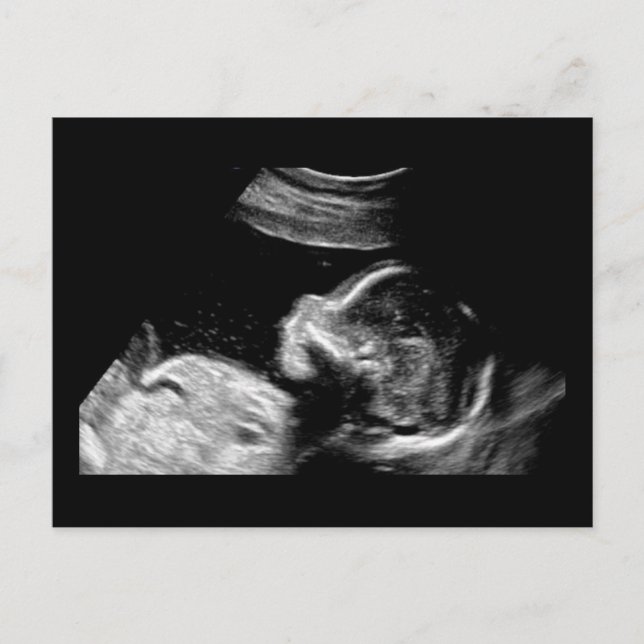 Carte Postale Bébé (Devant)