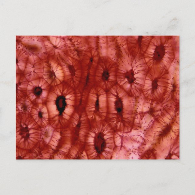 Carte Postale Cellules de Sclerenchyma d'un cerisier (Devant)