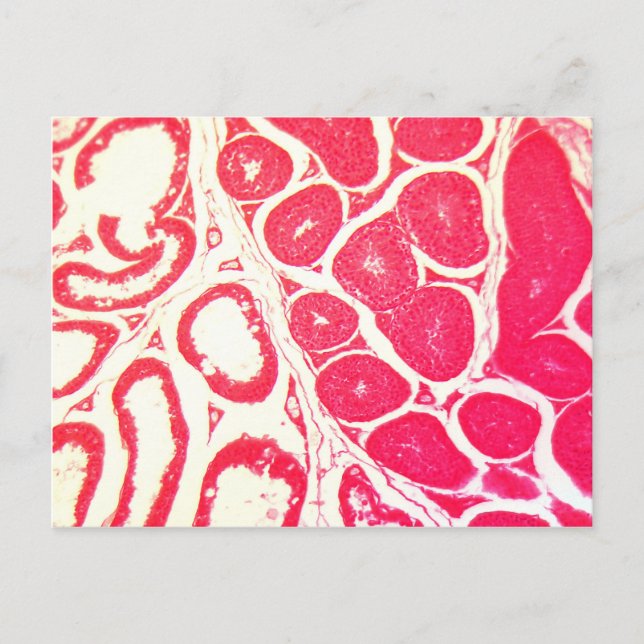 Carte Postale Cellules de testicules sous le microscope (Devant)