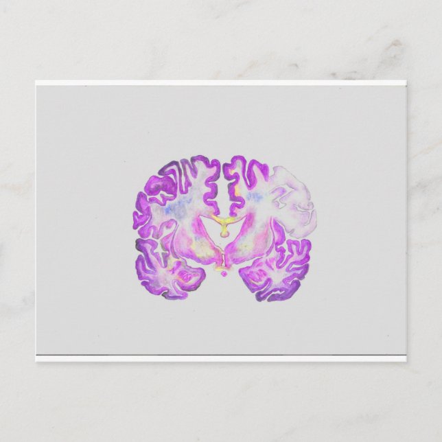 Carte Postale Cerveau (Devant)