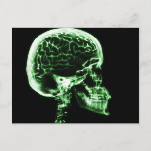 CARTE POSTALE CERVEAU JUMEAU X-RAY - VERT