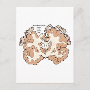 Carte Postale Coût d'un bras et d'une jambe homunculus