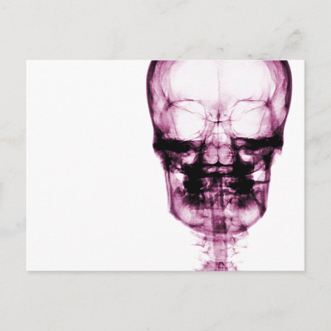 Carte Postale Crâne de vision à rayons X - rose (Devant)