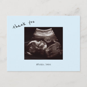 Carte Postale Échographie Baby Shower Cute Bleu Glacé Merci