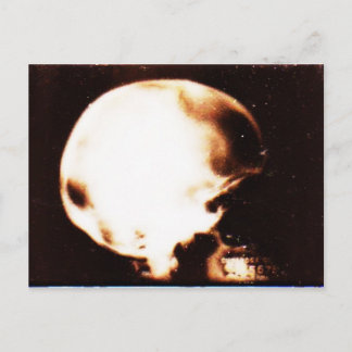 Carte Postale Empilé