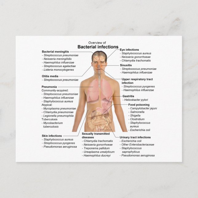 Carte Postale Graphique des infections bactériennes chez l'homme (Devant)