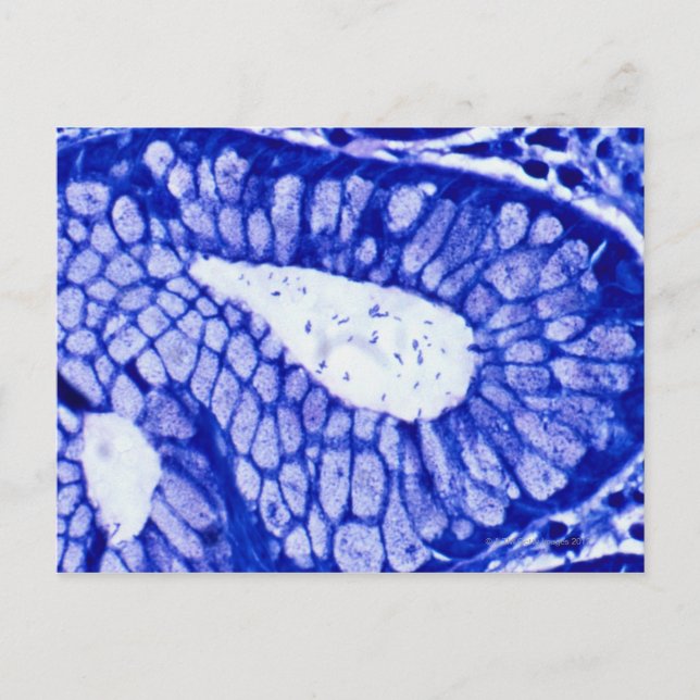 Carte Postale Helicobacter Pylori (Devant)