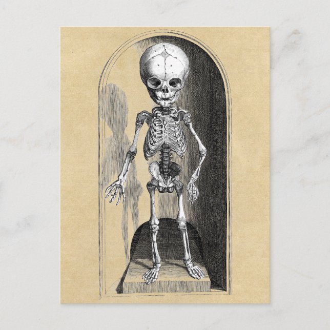 Carte Postale Illustration Médicale de Bidloo (antérieure) (Devant)