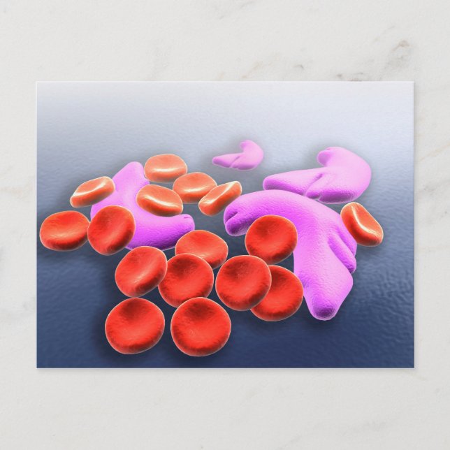Carte Postale Image Conceptuelle De L'Anémie Des Cellules De Fau (Devant)
