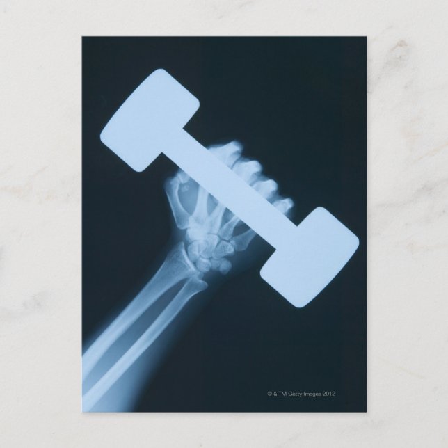 Carte Postale Image par rayons X de la main humaine avec poids,  (Devant)