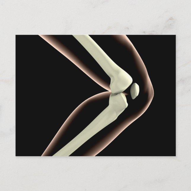 Carte Postale Image X-Ray Du Genou 1 (Devant)